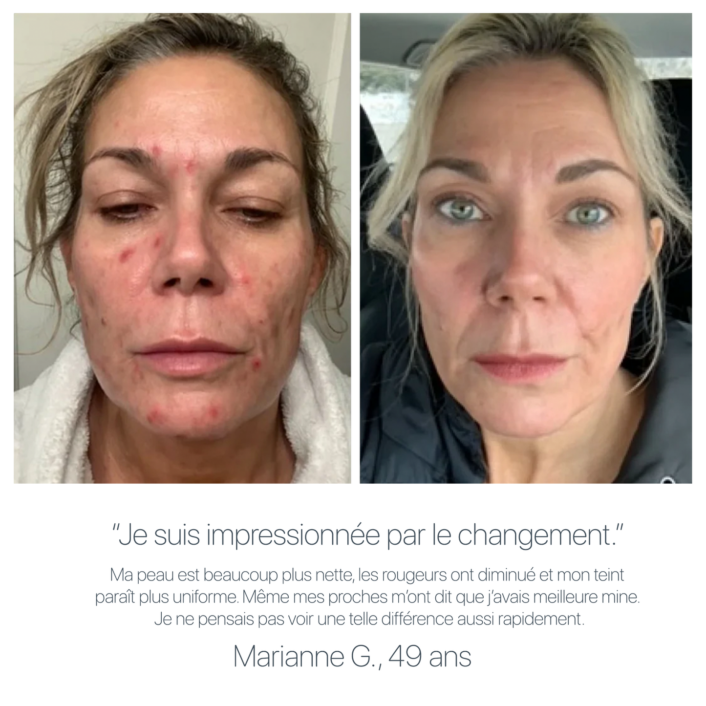 GLOWS LYFTA® Pro Anti-Âge 4 en 1