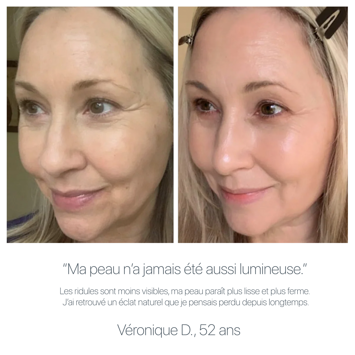 GLOWS LYFTA® Pro Anti-Âge 4 en 1